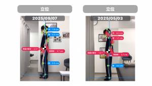姿勢改善のビフォーアフター 〜数ヶ月でここまで変わる〜